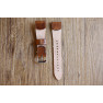Raspberry Minute Laser 2 Watch Strap